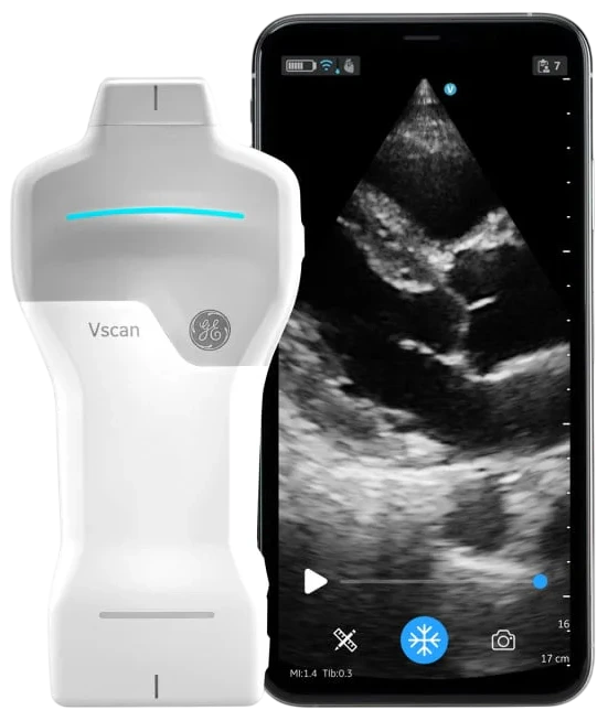 GE Vscan Air SL handheld ultrasound