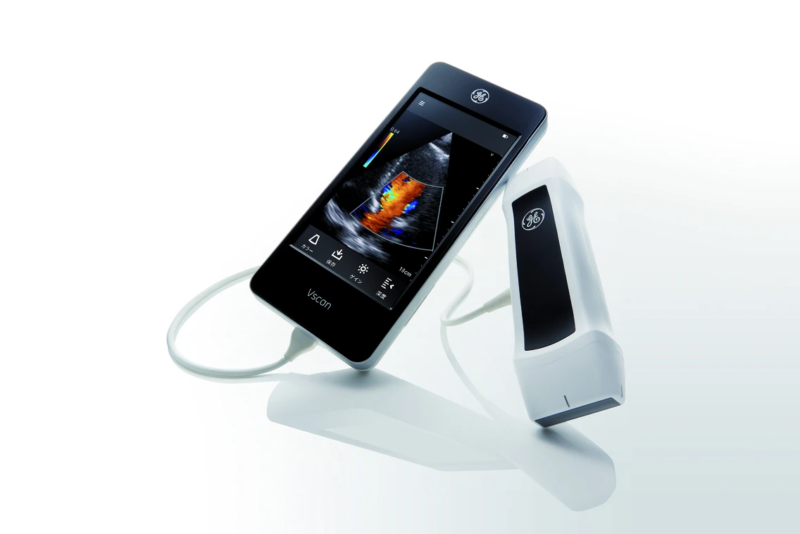 GE Vscan Extend R2 touchscreen handheld display with its dual-headed transducer