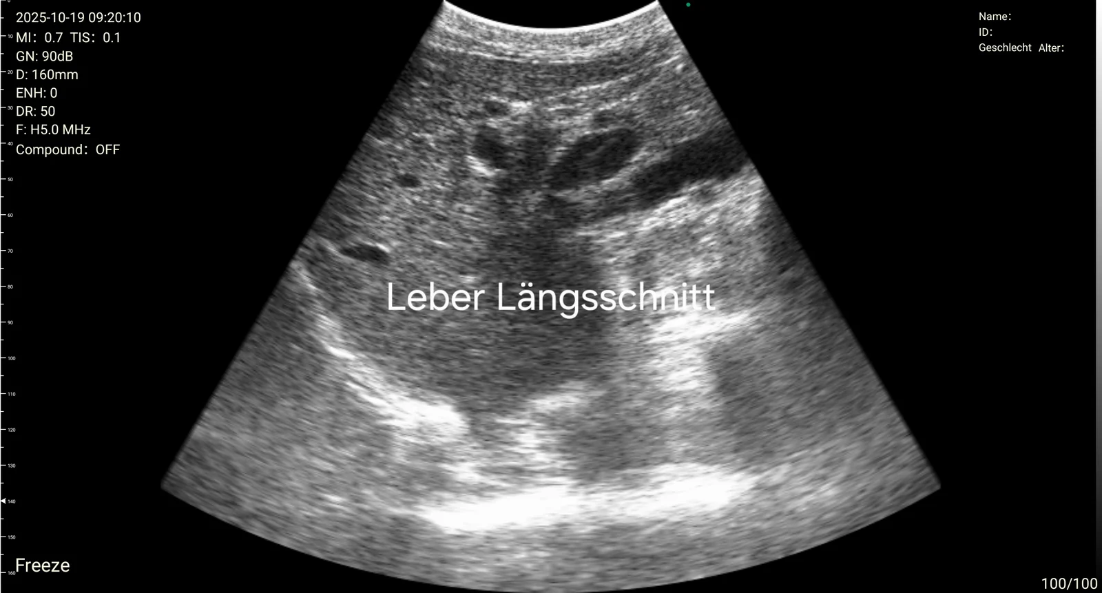 Internal Medicine: internal 03 longitudinal liver d3ultra