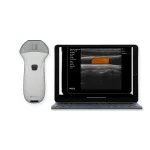 Suresult L14Pro 10/14MHz 휴대용 선형 초음파 프로브 (혈관 도플러 기능, 태블릿 화면 지원)