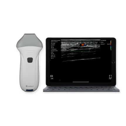 Eye Ultrasound Machine: E11 vs L20 Ocular Probe