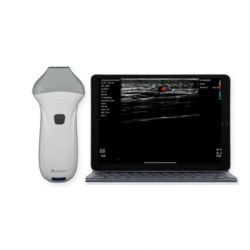 Suresult L20Pro 16/20MHz handheld linear ultrasound probe with color Doppler tablet screen