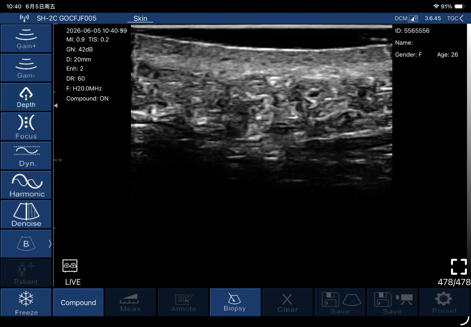 L20Pro 20 MHz B-mode ultrasound of skin and subcutaneous tissue, complete app interface