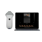 Suresult L24Pro 18/24MHz handheld aesthetic ultrasound probe with superficial vessel Doppler screen