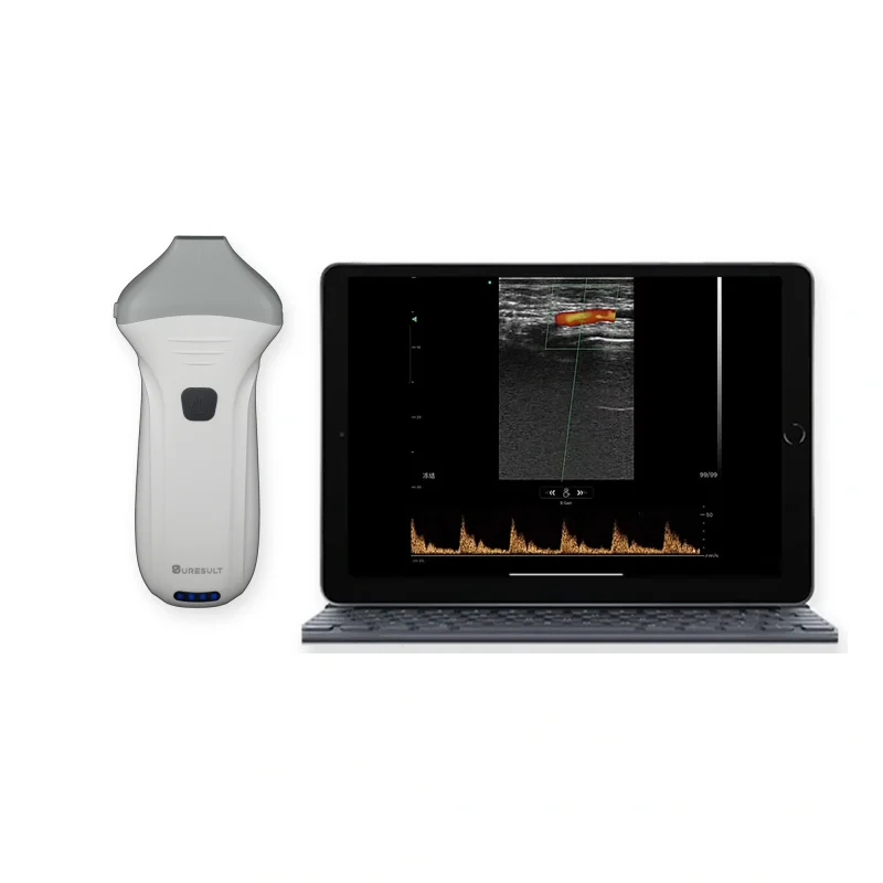 Suresult L24 Pro 18/24MHz handheld aesthetic ultrasound probe with superficial vessel Doppler screen