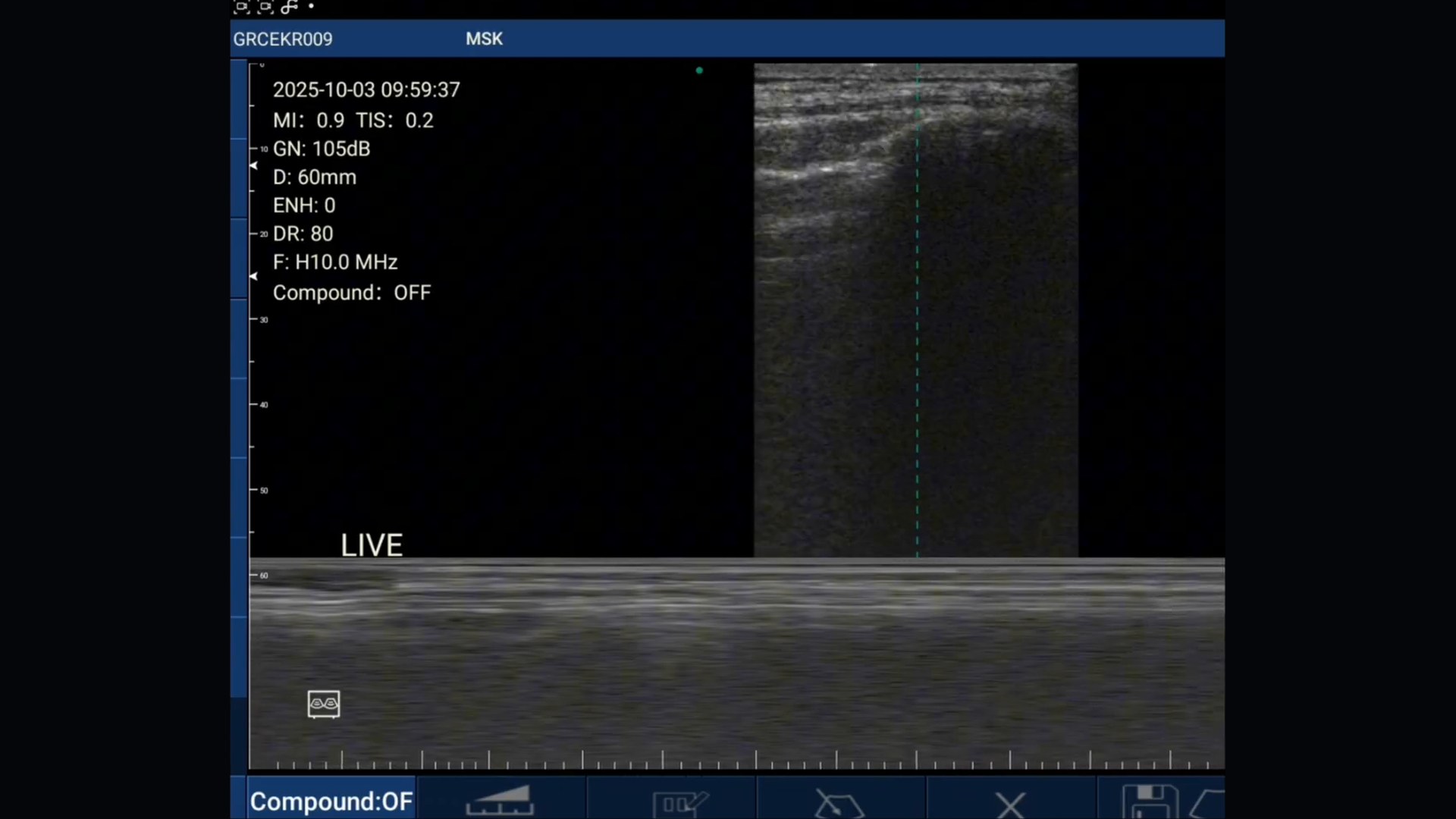 Live lung ultrasound on a handheld probe: bright pleural line in B-mode with a full-width M-mode strip below it, MSK preset at 60 mm depth and H10.0 MHz