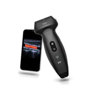 Mindray TE Air handheld ultrasound product image