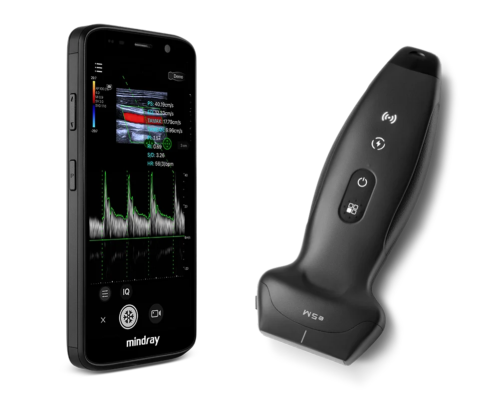 Sonda inalámbrica de ecografía de mano Mindray TE Air e5M junto a un teléfono