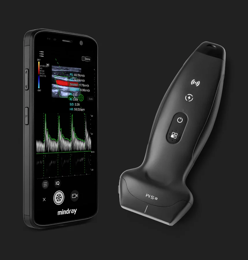 Mindray TE Air wireless phased-array ultrasound probe