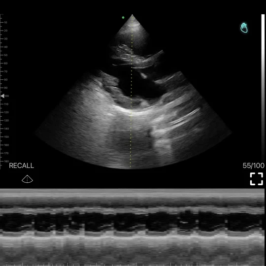 Cardiac M-mode reference