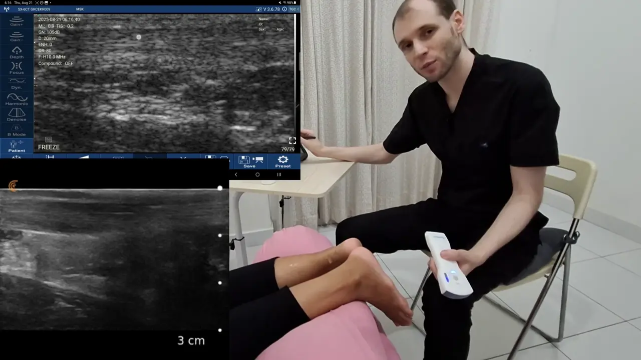 Musculoskeletal (MSK) Medicine: msk 02 achilles tendon long axis