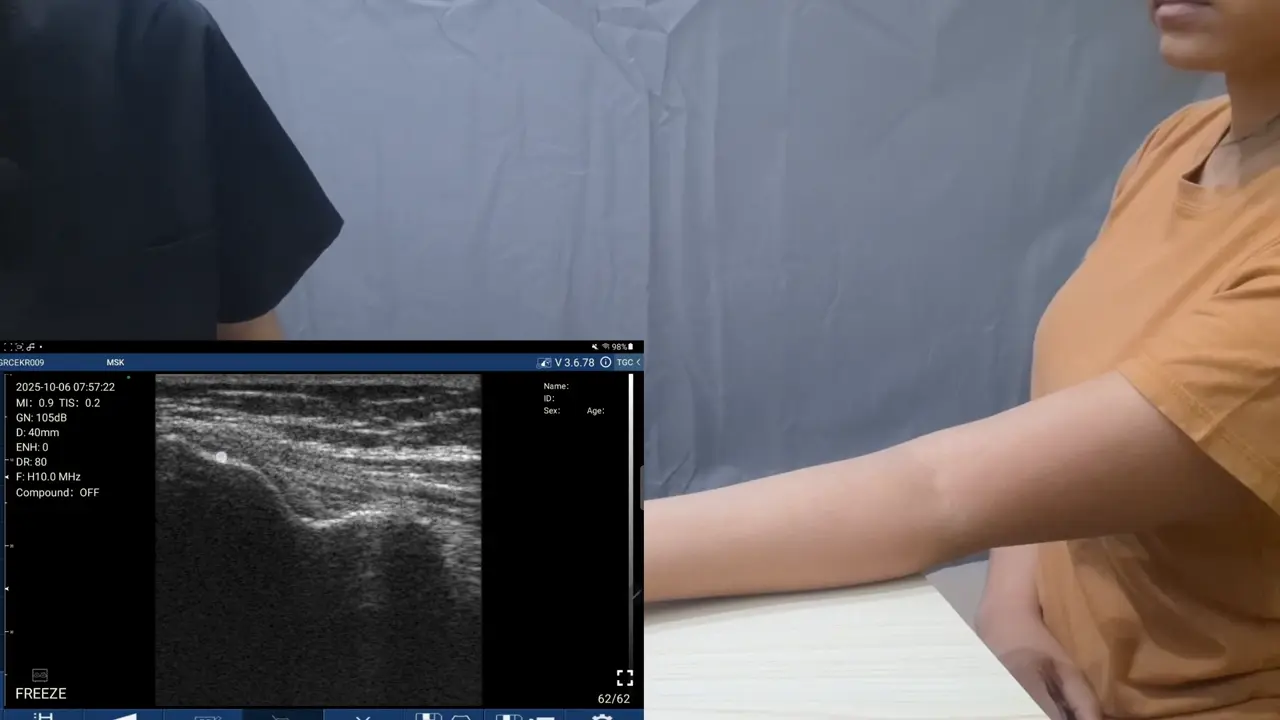 Medial elbow in golfer's elbow