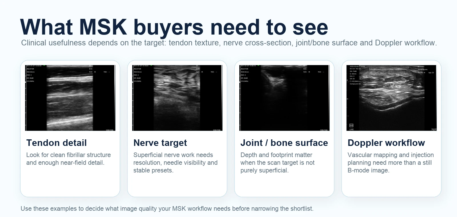 Voorbeelden van scancontext voor MSK-echografie met peesdetails, zenuwdoel, gewrichts- of botoppervlak en overwegingen voor dopplerworkflows