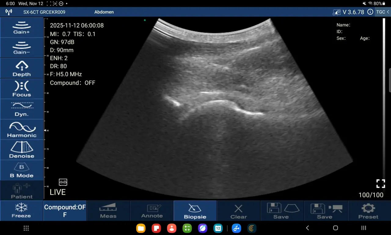 Neonatology: neonatology 04 anterior hip joint d3ultra