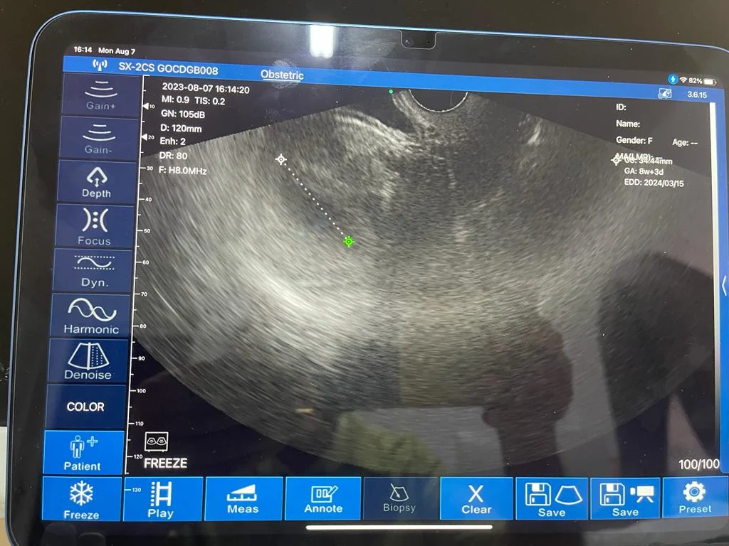 8w+3d on the Obstetric preset, whole app screen