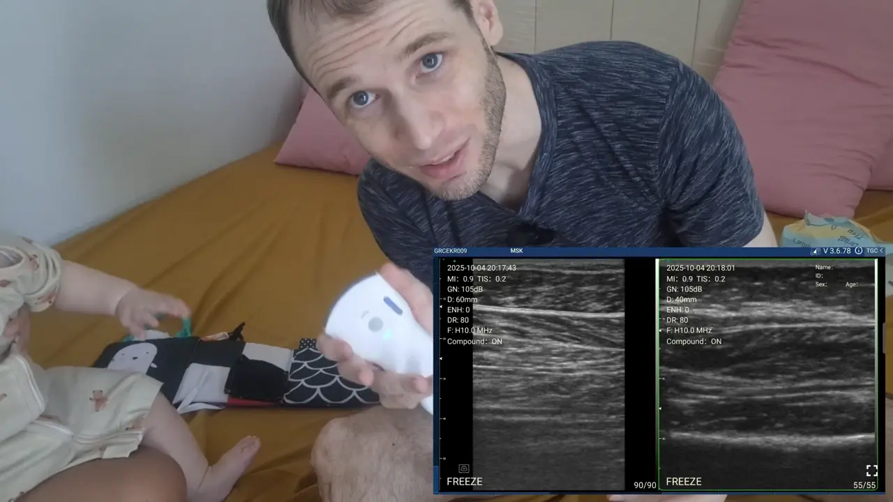 Kuit van een zes maanden oude baby vergeleken met een volwassene op de D3Ultra
