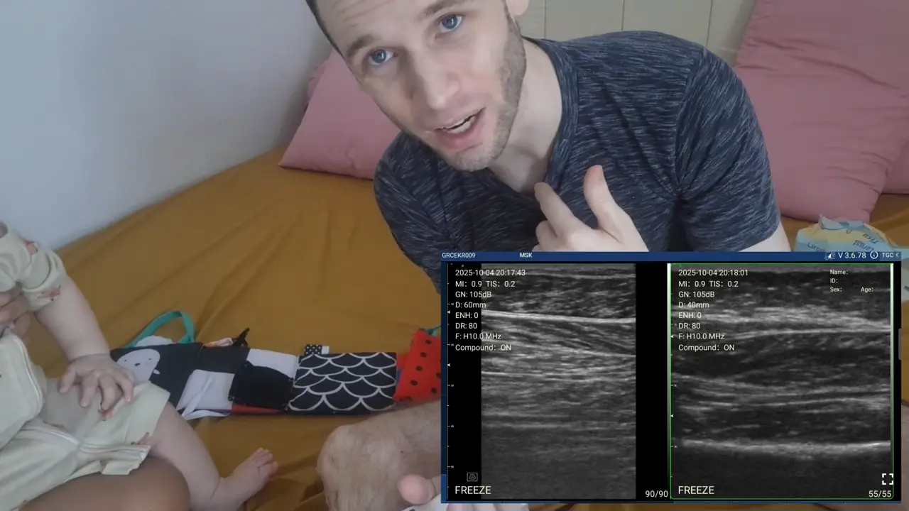 Pediatrics: pediatrics 01 calf achilles six month old adult