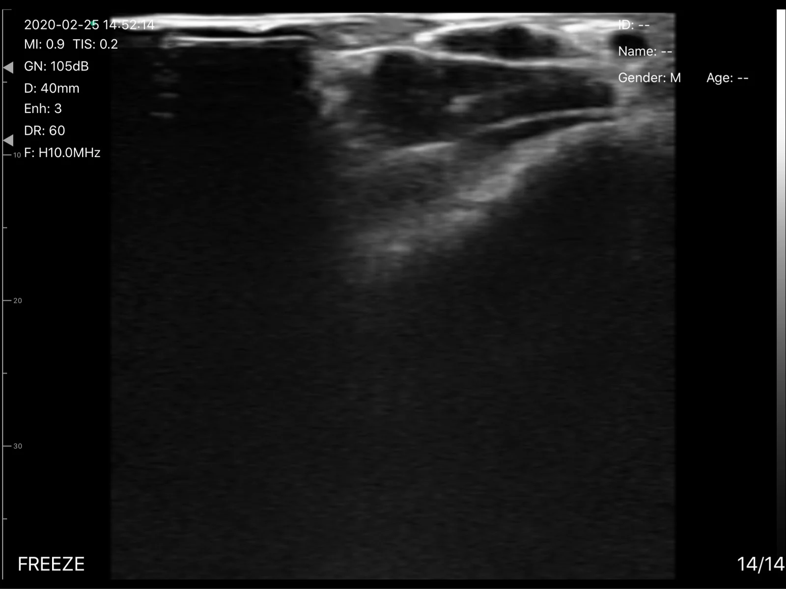 Wrist and hand soft tissue at 10 MHz