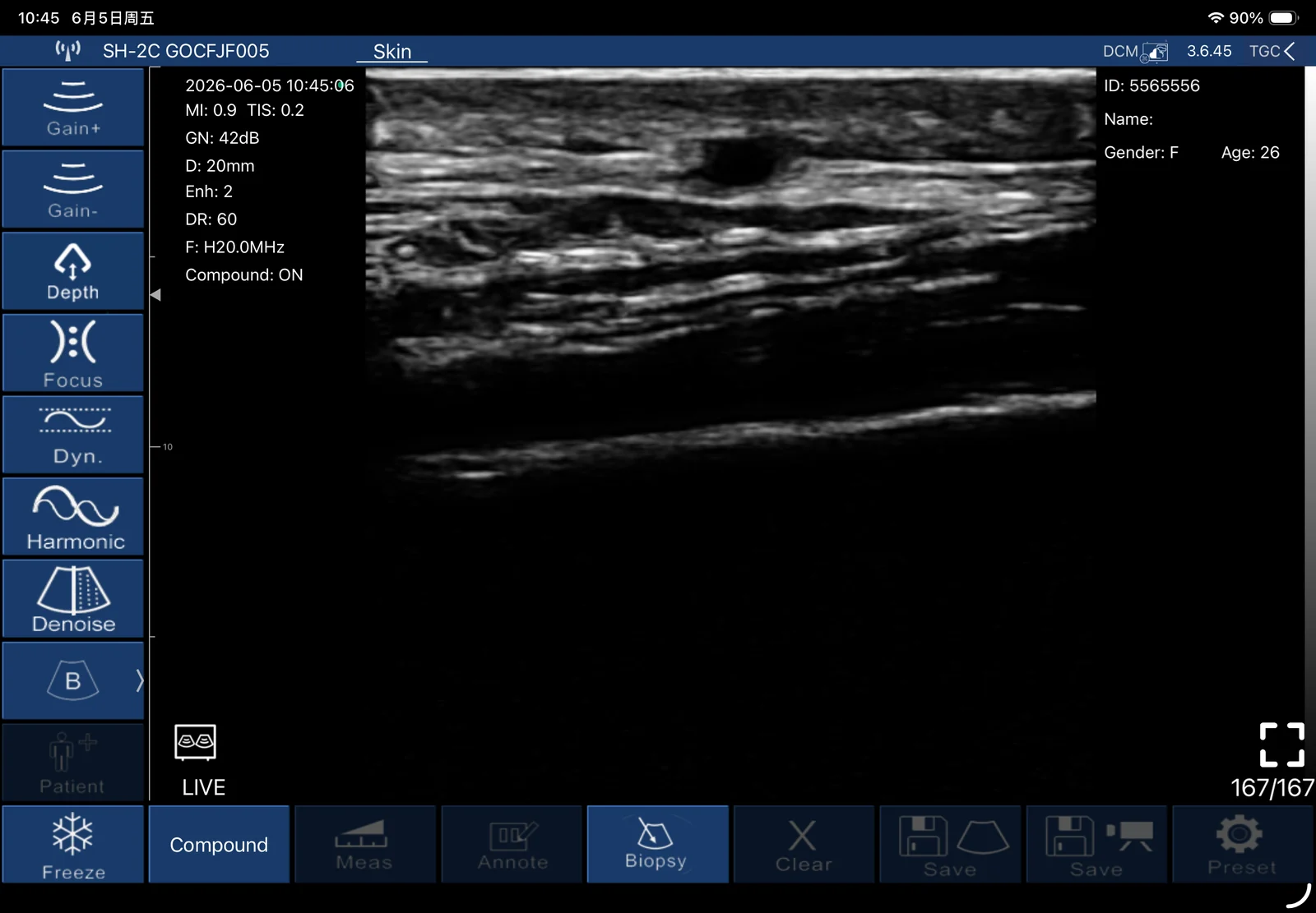 Epidermal, dermal and hypodermal layers at 20 MHz on a Suresult L20Pro, 20 mm depth