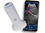 portable lightweight handheld ultrasound convex probe c5sh