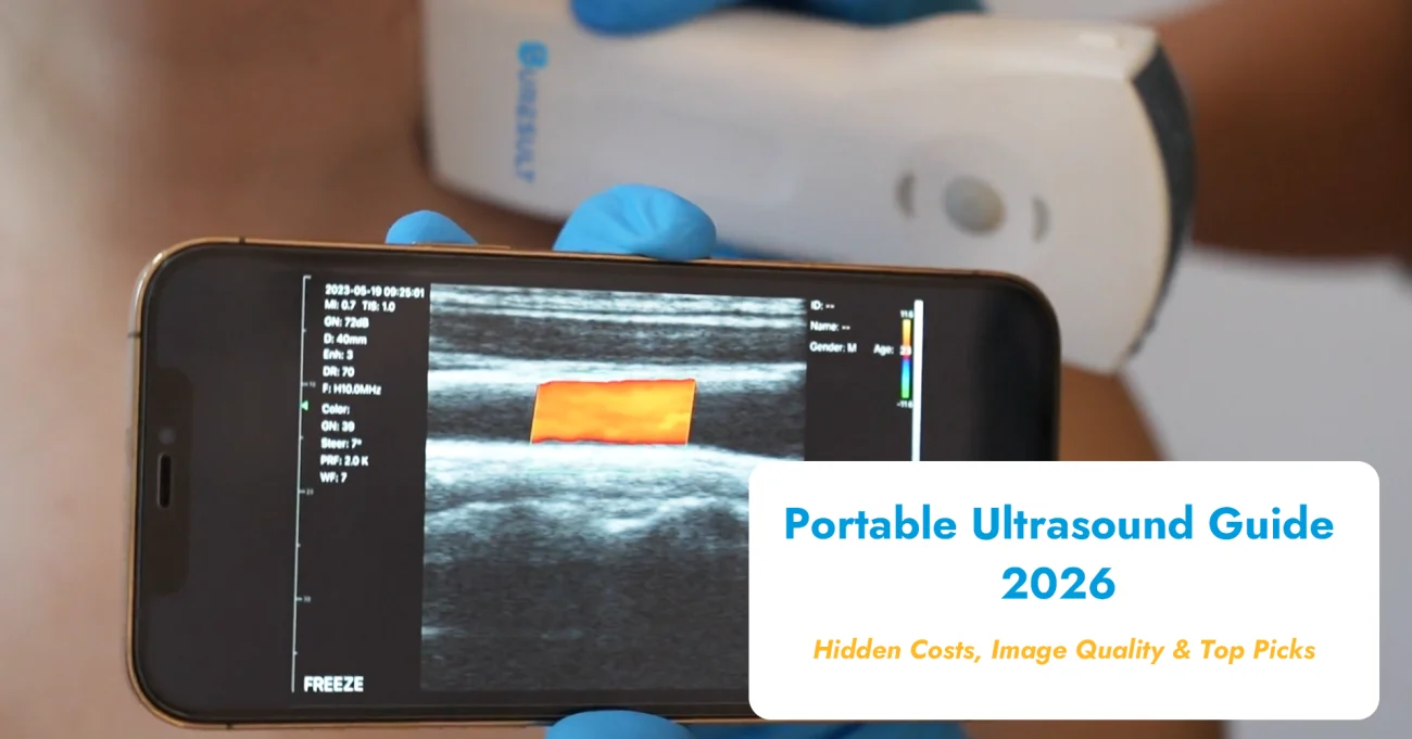 guide de l'échographie portable 2026 coûts cachés qualité de l'image top choix
