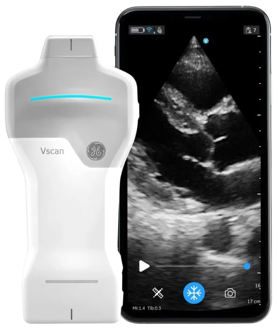Productafbeelding van GE Vscan Air SL handheld echografie voor cardiale en vasculaire vergelijking