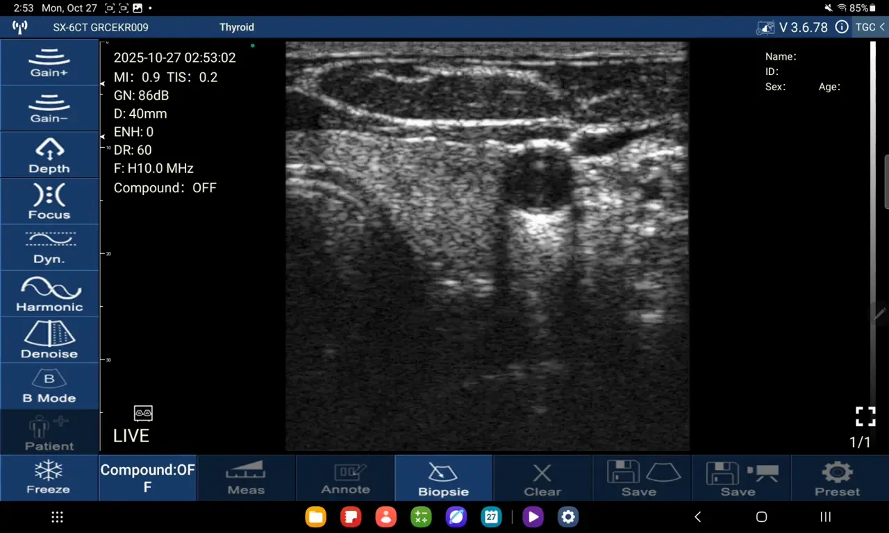 Thyroid nodule survey on the D3Ultra