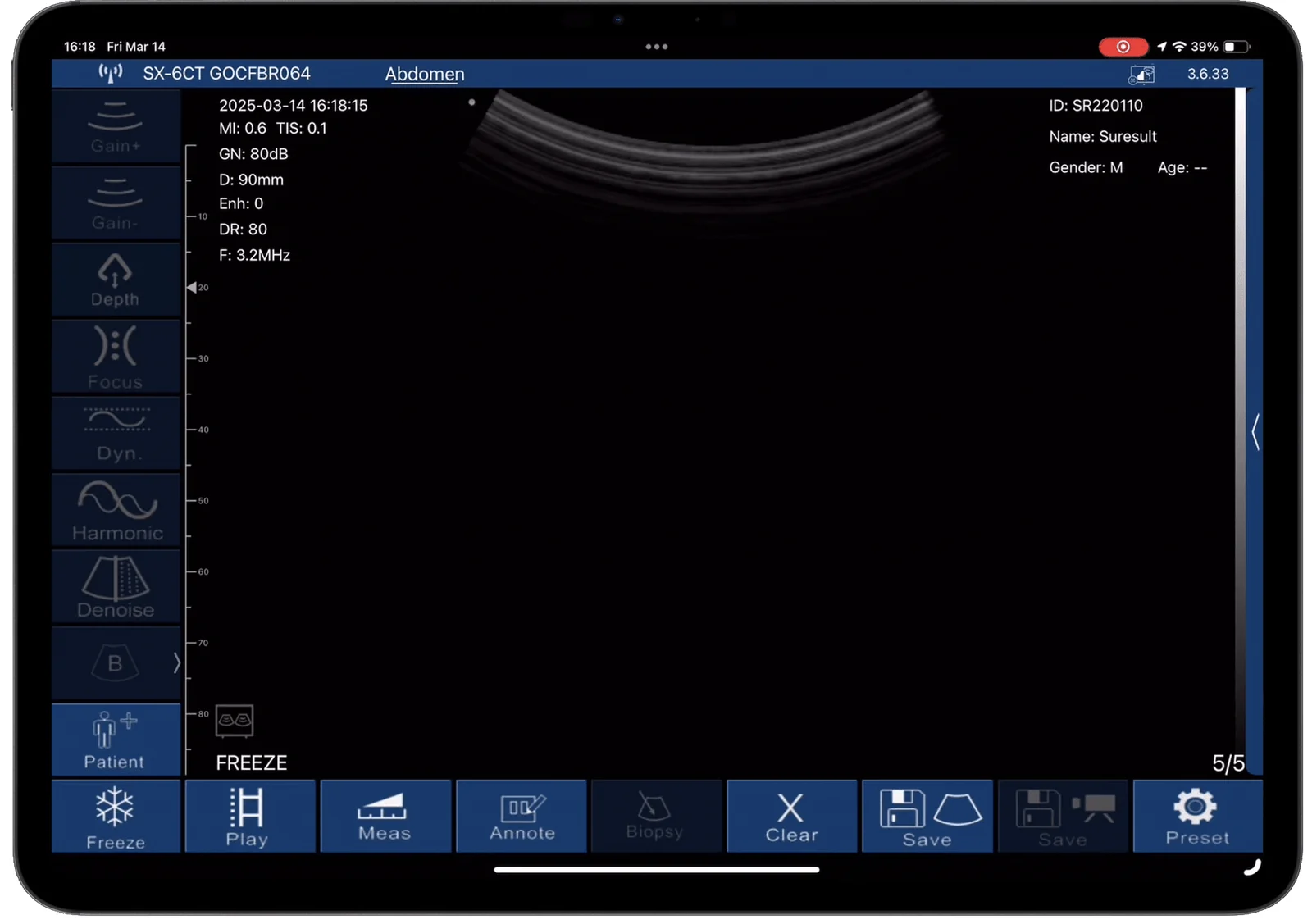 Load the preset, then set depth once.