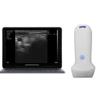 Suresult L10SH high-definition linear ultrasound scanner