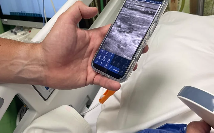 Bedside phone-screen ultrasound during an acute case