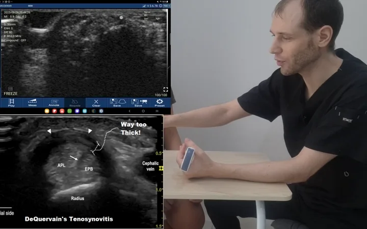Clinician performing a desk-side ultrasound scan of a patient's wrist in a clinic room
