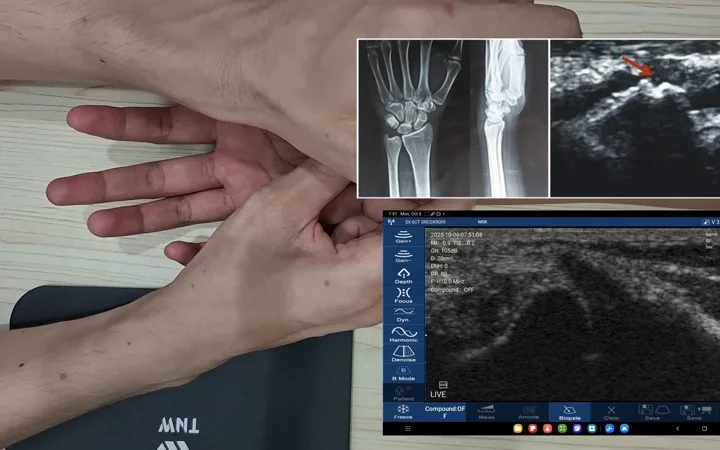 Fine superficial hand exam with high-frequency imaging