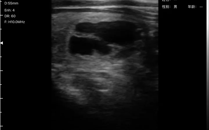 Thyroid ultrasound scan on a tablet beside a handheld linear probe