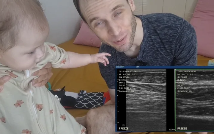 House-call scan with a handheld probe and split-screen exam