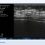 Suresult D3Ultra software window during a rib scan: a continuous bright cortical line running the length of the rib in long axis with clean acoustic shadow beneath, 40 mm depth and H10.0 MHz on the linear head