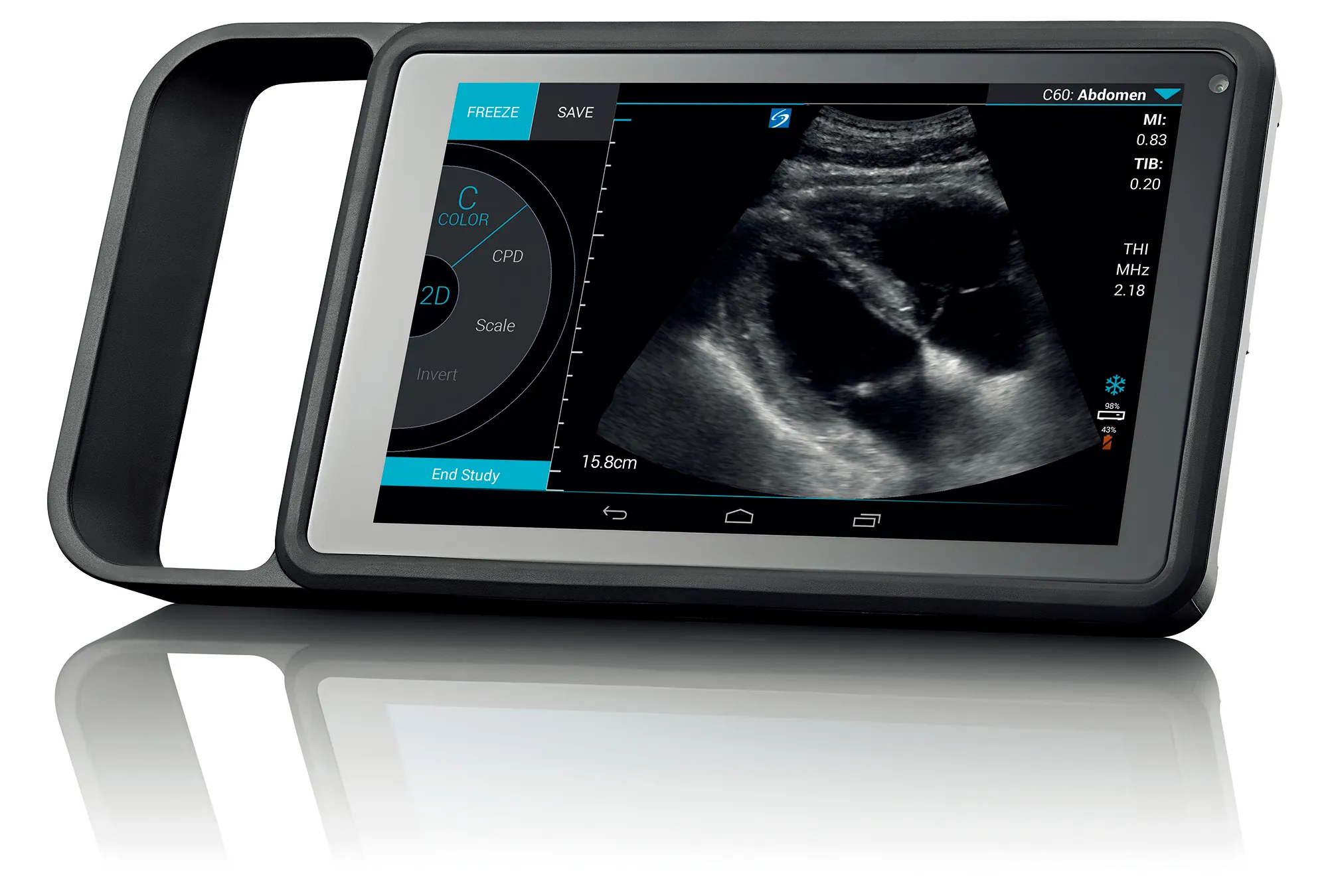 Système d'échographie portable Fujifilm Sonosite iViz sur tablette, avec sa sonde filaire, photographié sous un angle sur un fond uni