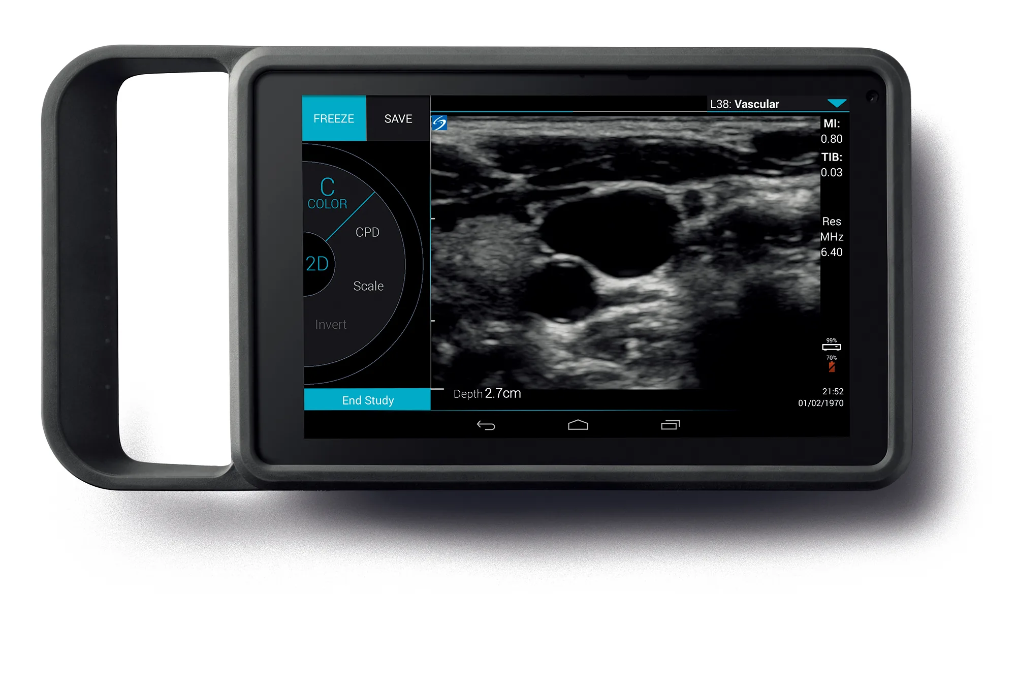 Fujifilm Sonosite iViz Tablet-Ultraschallsystem mit kabelgebundenem Schallkopf