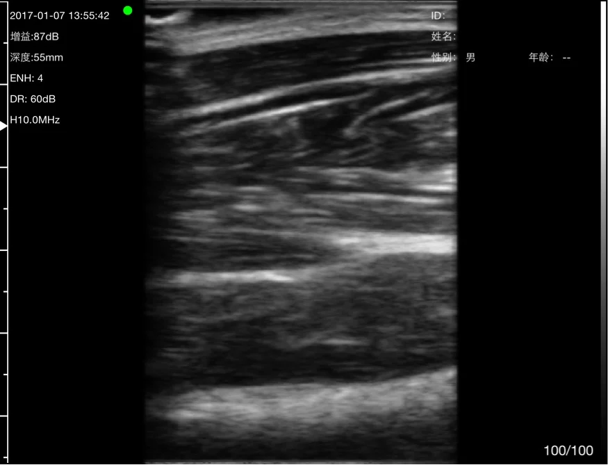 Pennate muscle architecture in long axis