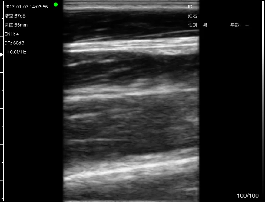 Fibrillar tendon in long axis