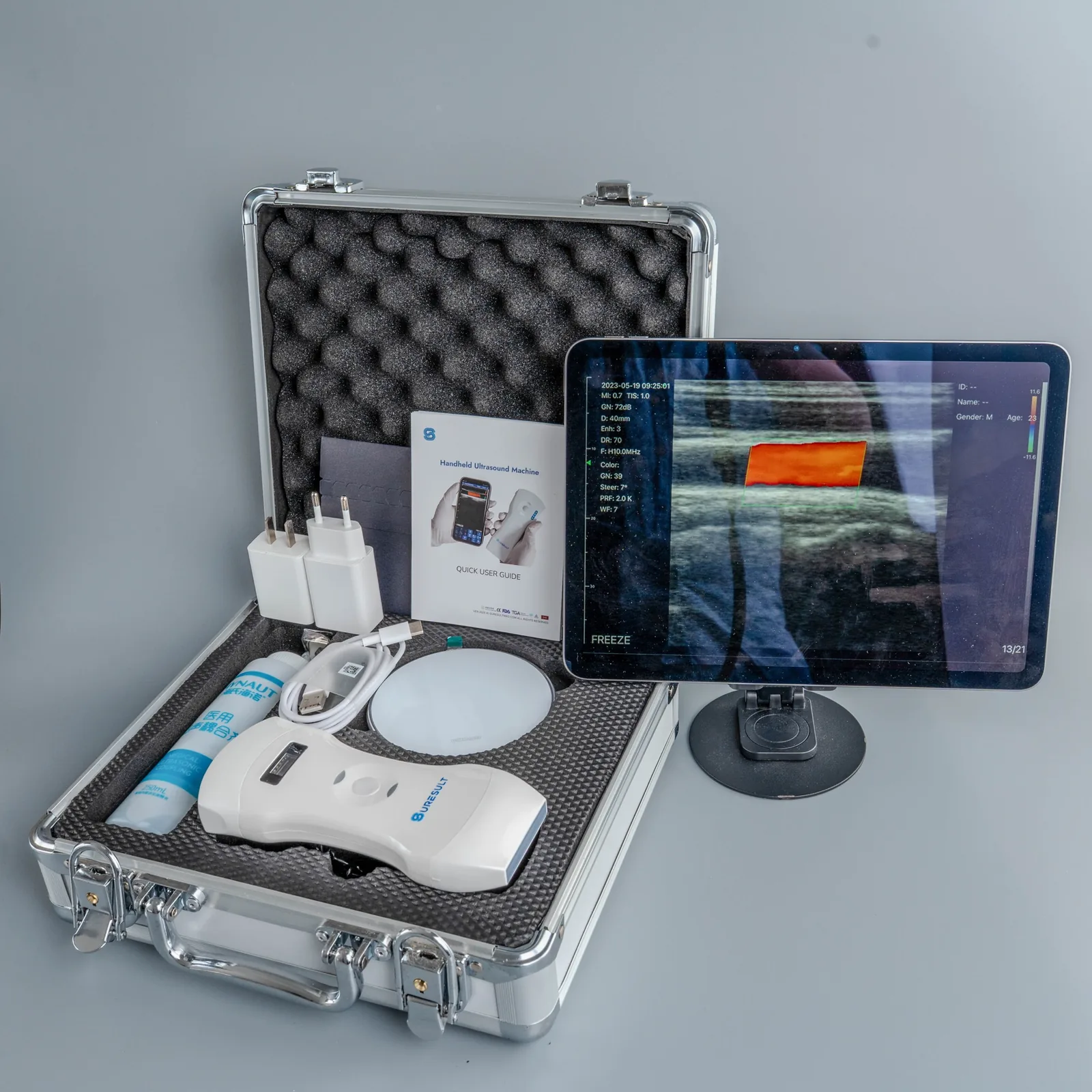 Suresult handheld ultrasound kit: aluminium case with the probe, wireless charging pad, plugs and quick user guide, beside a tablet running a live colour Doppler scan