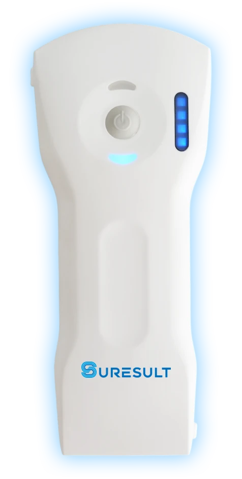 The Suresult D3Ultra tri-mode handheld ultrasound