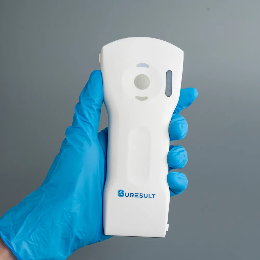 Een Suresult D3Ultra handheld echografieprobe vastgehouden in een gehandschoende hand