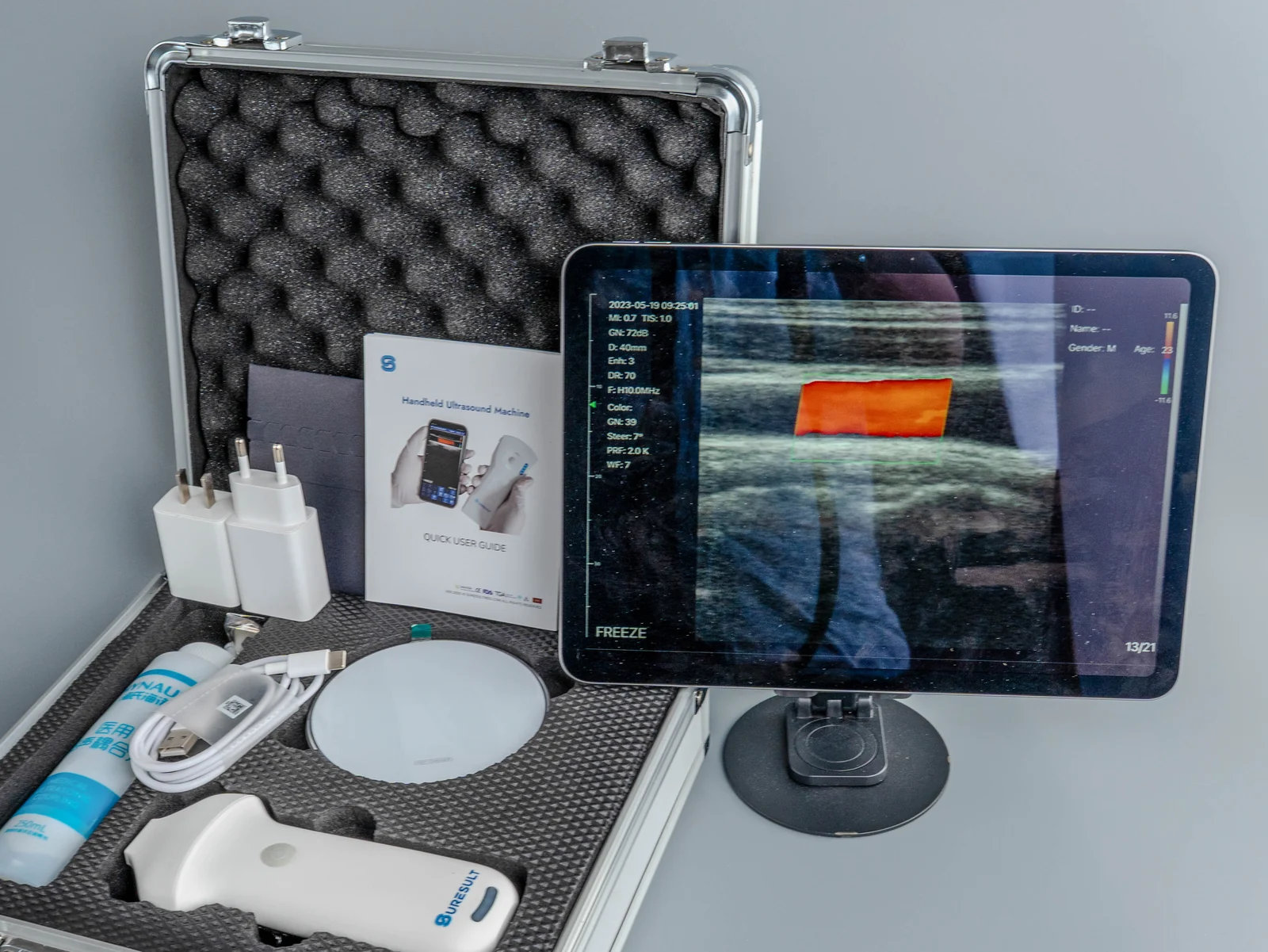 De Suresult echografie-app die een live kleurendopplerscan uitvoert op een tablet naast de open koffer