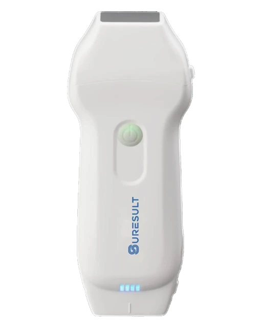 CD2 handheld echografie, vooraanzicht