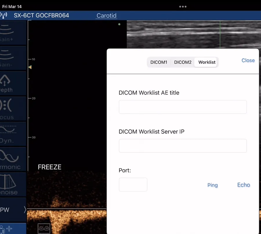 DICOM worklist and store settings on the ultrasound app