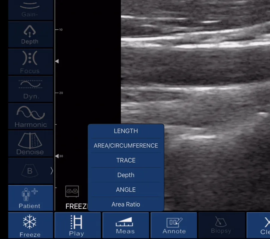 On-screen measurement menu with length and depth tools