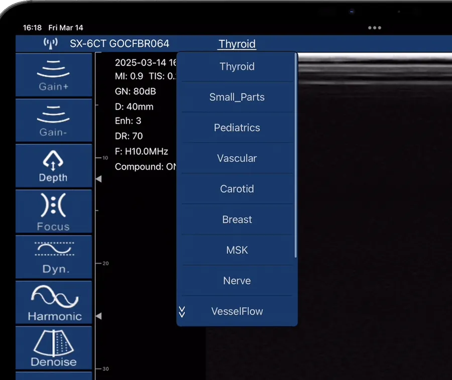Preset list on the handheld ultrasound app including Nerve and MSK