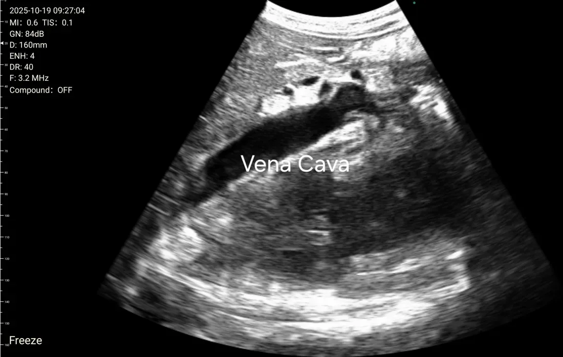 Critical Care ultrasound