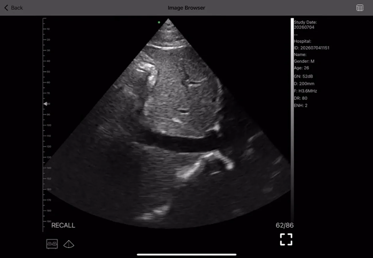 Emergency Medicine ultrasound key frame