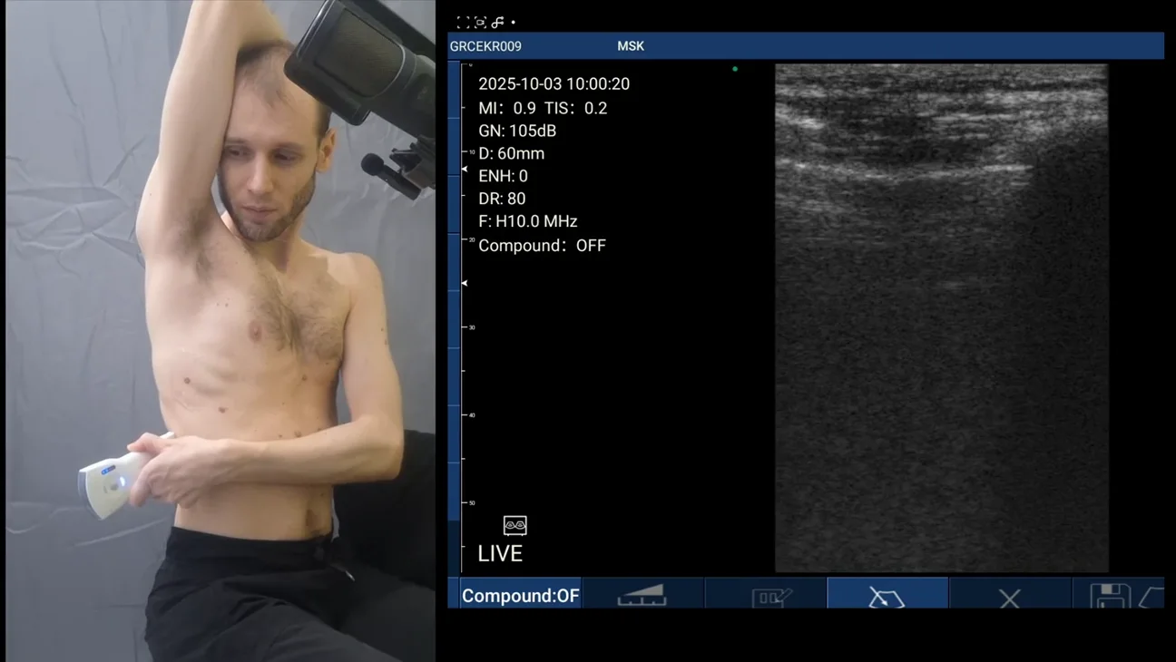 EMS (Emergency Medical Services) ultrasound key frame